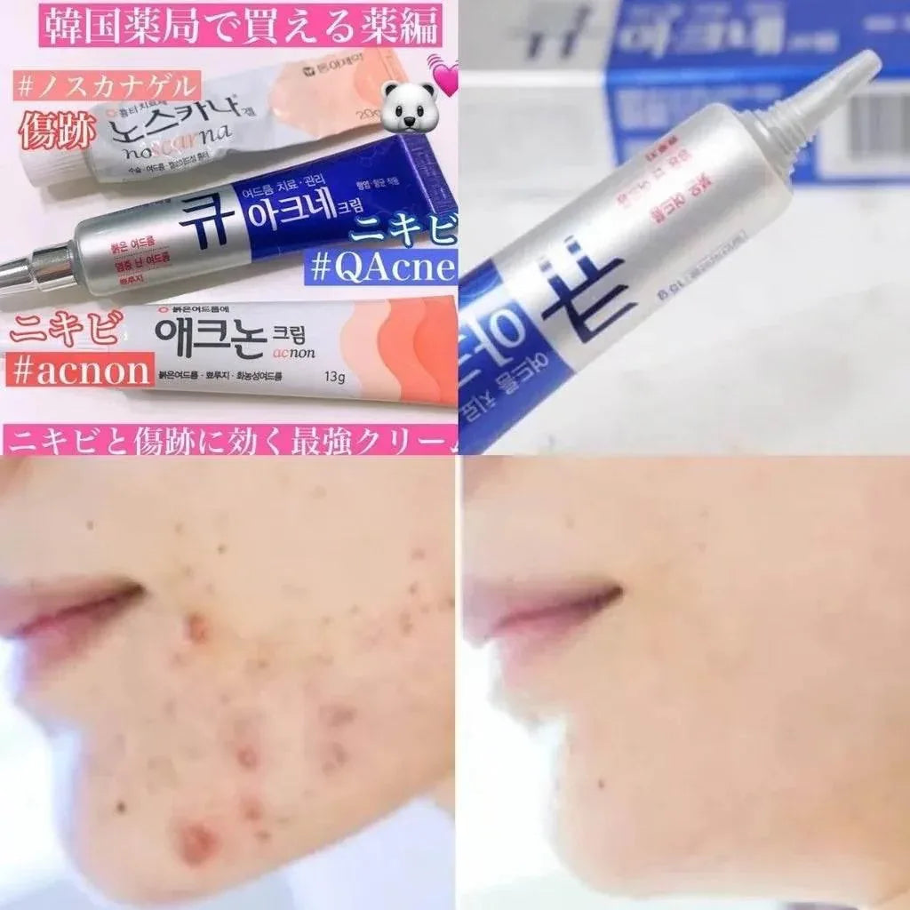 Kwangdong Q Acne Cream 15g