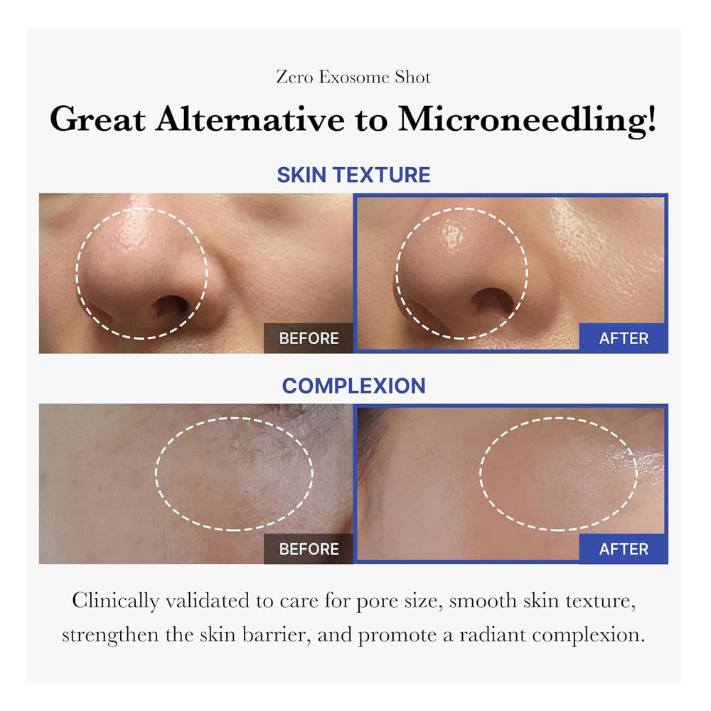 Medicube One Day Exosome Shot Pore Ampoule 2000 - 30ml