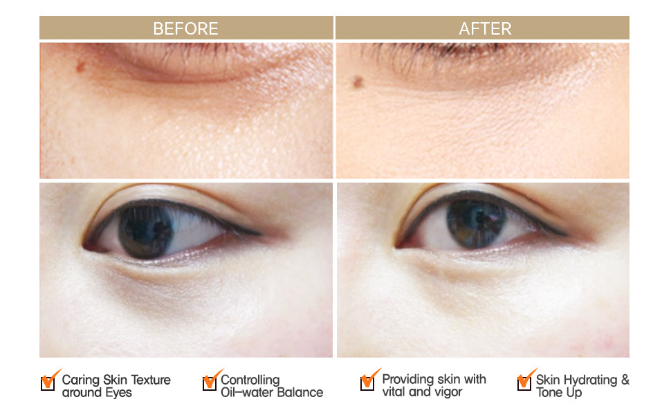 [The Orchid Skin] Smoky Under Clear Eye Patch 1pack(10patches)