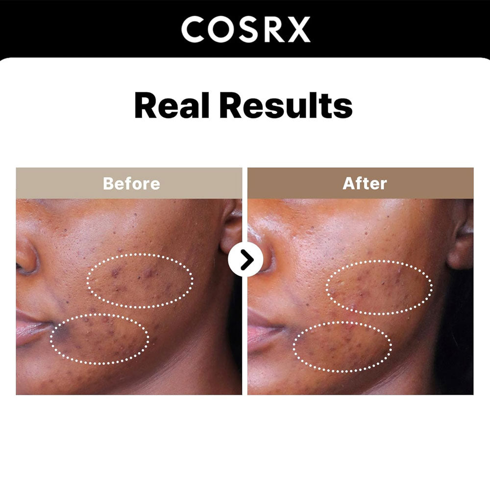 Cosrx The Alpha-Arbutin 2 Discoloration Care Serum 50ml