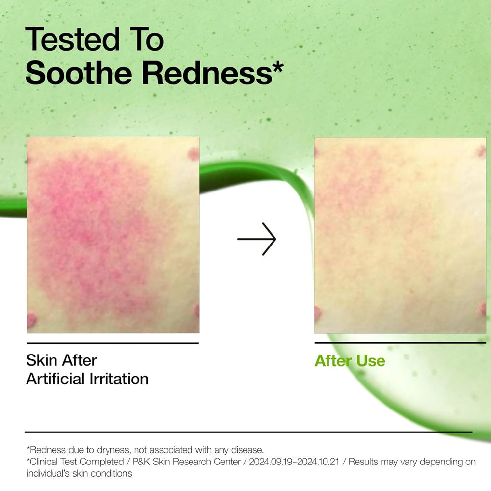 Anua-Azelaic Acid 10 Hyaluron Redness Soothing Serum 30ml