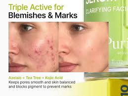 Purito Seoul Azelaic Acid 10% Kojic Tea Tree Serum 30ml