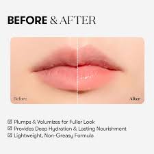 VT Cosmetics Reedle Shot Lip Plumper (Beginner)