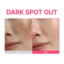 Purito Seoul TXA 6% Niacinamide 10% Retinal Serum 30ml
