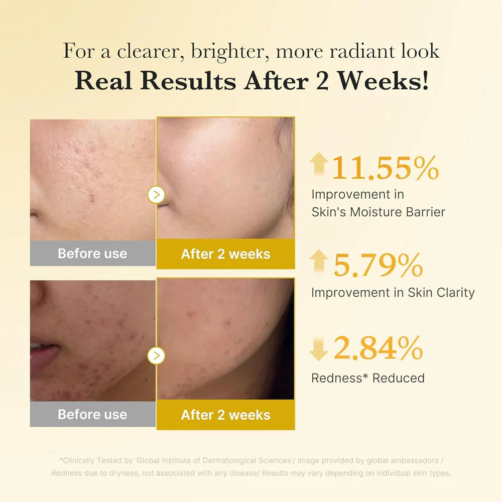 Medicube niacinamide 5 percent serum for dark spots